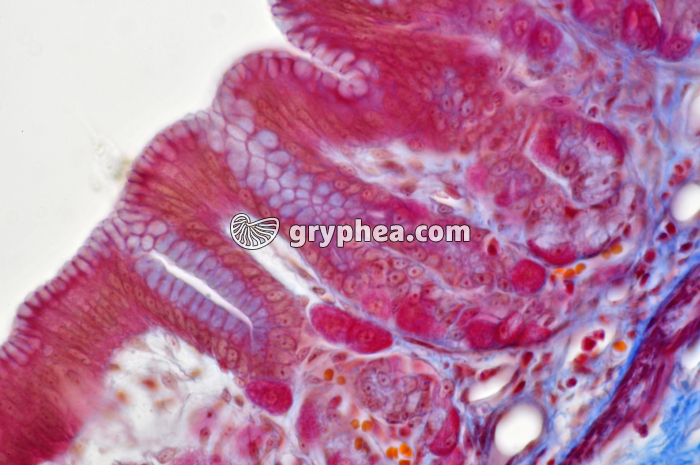 Estomac pylorique x160 - gryphea.com